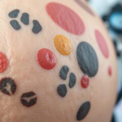 Rzadkie choroby skóry – objawy, diagnostyka i leczenie