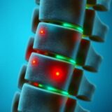 Dyskopatia: Przyczyny, objawy i skuteczne metody leczenia