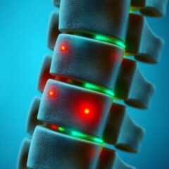 Dyskopatia: Przyczyny, objawy i skuteczne metody leczenia