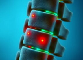 Dyskopatia: Przyczyny, objawy i skuteczne metody leczenia